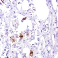 Immunohistochemistry (Formalin/PFA-fixed paraffin-embedded sections) - Anti-GCDFP 15 antibody [SP185] - BSA and Azide free (AB238776)