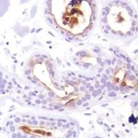 Immunohistochemistry (Formalin/PFA-fixed paraffin-embedded sections) - Anti-GCDFP 15 antibody [SP185] - BSA and Azide free (AB238776)