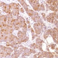Immunohistochemistry (Formalin/PFA-fixed paraffin-embedded sections) - Anti-GCDFP 15 antibody [SP185] - C-terminal (ab183321), expandable thumbnail