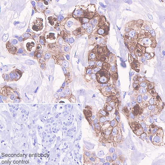 Immunohistochemistry (Formalin/PFA-fixed paraffin-embedded sections) - Anti-GCDFP 15 antibody [SP185] - C-terminal (AB183321), expandable thumbnail