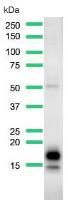 Western blot - Anti-GCDFP 15 antibody [SP185] - C-terminal (AB183321), expandable thumbnail