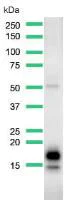 Western blot - Anti-GCDFP 15 antibody [SP185] - C-terminal (AB183321)