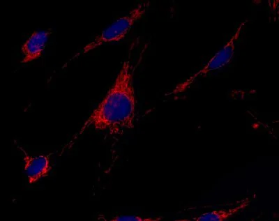 Immunocytochemistry/ Immunofluorescence - Anti-GCDH/GCD antibody [3E9BA3BF5] (AB112998)