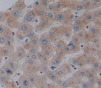 Immunohistochemistry (Formalin/PFA-fixed paraffin-embedded sections) - Anti-GCDH/GCD antibody (AB232774)