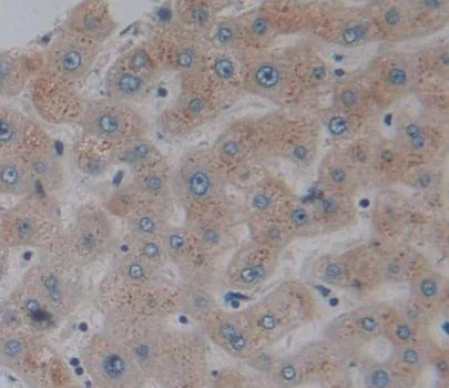 Immunohistochemistry (Formalin/PFA-fixed paraffin-embedded sections) - Anti-GCDH/GCD antibody (AB232774)