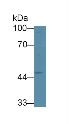 Western blot - Anti-GCDH/GCD antibody (AB232774)