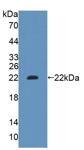 Western blot - Anti-GCDH/GCD antibody (AB232774)