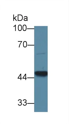 Western blot - Anti-GCDH/GCD antibody (AB232774)