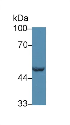 Western blot - Anti-GCDH/GCD antibody (AB232774)