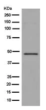 Western blot - Anti-GCDH/GCD antibody [EPR14864(B)] (AB182152)