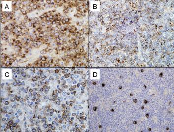 Immunohistochemistry (Formalin/PFA-fixed paraffin-embedded sections) - Anti-GCET1 antibody [RAM341] (AB68889)