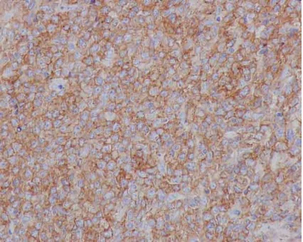 Immunohistochemistry (Formalin/PFA-fixed paraffin-embedded sections) - Anti-GCET2 antibody [EPR14333] - BSA and Azide free (AB250826)