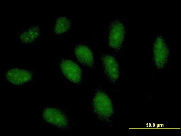 Immunocytochemistry/ Immunofluorescence - Anti-GCH1 antibody (AB69962)