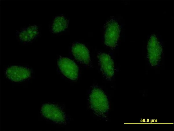 Immunocytochemistry/ Immunofluorescence - Anti-GCH1 antibody (AB69962)