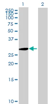 Western blot - Anti-GCH1 antibody (AB69962)
