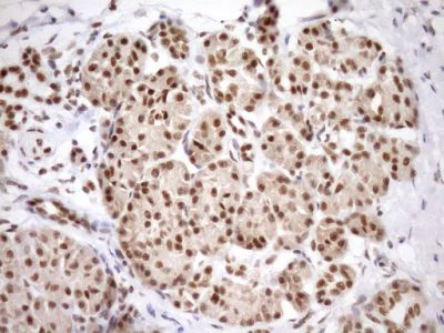 Immunohistochemistry (Formalin/PFA-fixed paraffin-embedded sections) - Anti-GCIP interacting protein p29 antibody [OTI6A5] (AB236417)