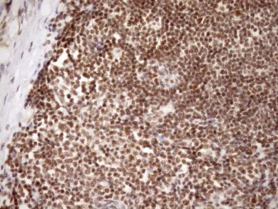 Immunohistochemistry (Formalin/PFA-fixed paraffin-embedded sections) - Anti-GCIP interacting protein p29 antibody [OTI6A5] (AB236417)