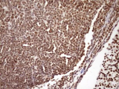 Immunohistochemistry (Formalin/PFA-fixed paraffin-embedded sections) - Anti-GCIP interacting protein p29 antibody [OTI6A5] (AB236417)