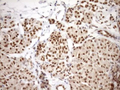 Immunohistochemistry (Formalin/PFA-fixed paraffin-embedded sections) - Anti-GCIP interacting protein p29 antibody [OTI6A5] (AB236417)