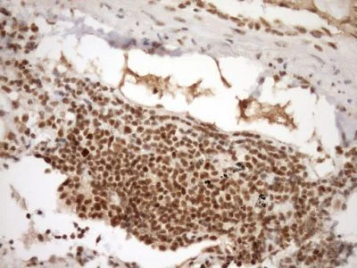 Immunohistochemistry (Formalin/PFA-fixed paraffin-embedded sections) - Anti-GCIP interacting protein p29 antibody [OTI6A5] (AB236417)