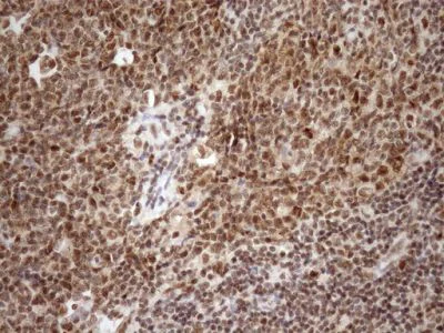 Immunohistochemistry (Formalin/PFA-fixed paraffin-embedded sections) - Anti-GCIP interacting protein p29 antibody [OTI6A5] (AB236417)