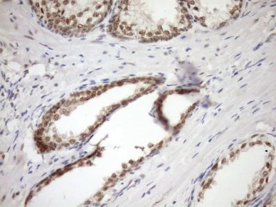 Immunohistochemistry (Formalin/PFA-fixed paraffin-embedded sections) - Anti-GCIP interacting protein p29 antibody [OTI6A5] (AB236417)