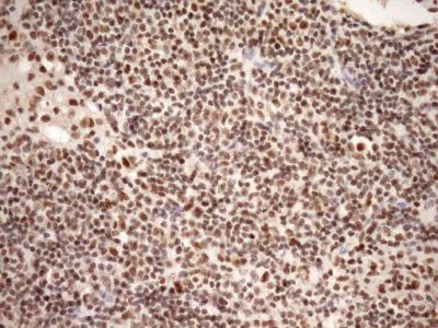 Immunohistochemistry (Formalin/PFA-fixed paraffin-embedded sections) - Anti-GCIP interacting protein p29 antibody [OTI6A5] (AB236417)