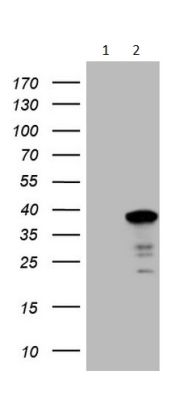 Western blot - Anti-GCIP interacting protein p29 antibody [OTI6A5] (AB236417)