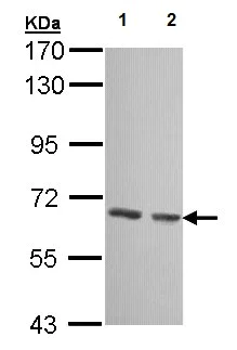 Western blot - Anti-GCKR antibody (AB154120)