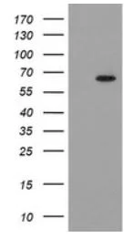 Western blot - Anti-GCKR antibody [OTI1E7] (AB279376)