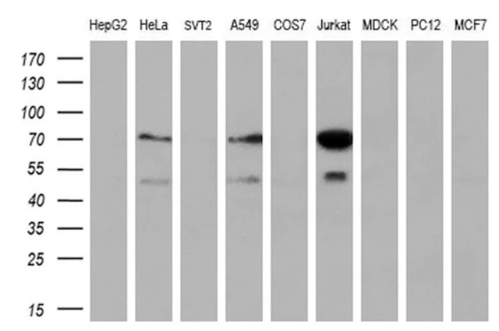 Western blot - Anti-GCKR antibody [OTI1E7] (AB279376)