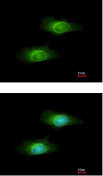 Immunocytochemistry/ Immunofluorescence - Anti-GCLM antibody (AB153967), expandable thumbnail