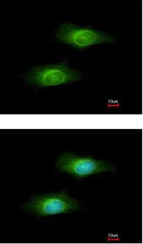 Immunocytochemistry/ Immunofluorescence - Anti-GCLM antibody (AB153967)