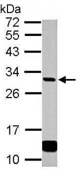 Western blot - Anti-GCLM antibody (AB153967), expandable thumbnail