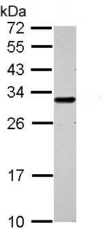 Western blot - Anti-GCLM antibody (AB153967), expandable thumbnail