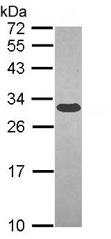 Western blot - Anti-GCLM antibody (AB153967), expandable thumbnail