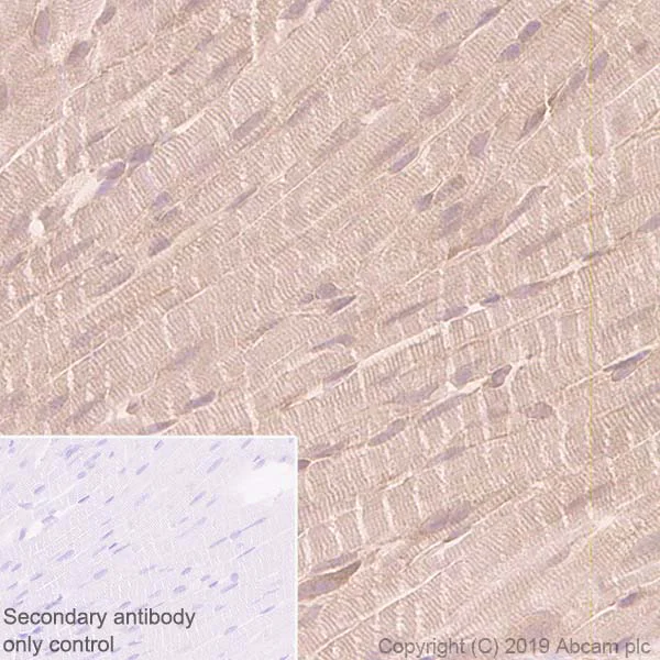 Immunohistochemistry (Formalin/PFA-fixed paraffin-embedded sections) - Anti-GCLM antibody [EPR6667] (AB126704)