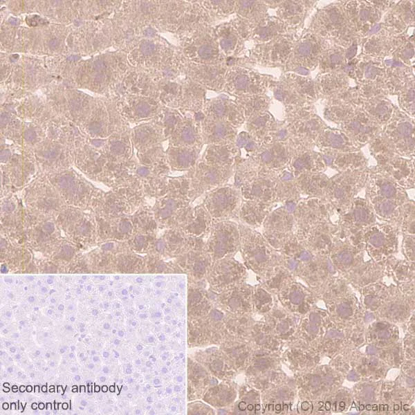 Immunohistochemistry (Formalin/PFA-fixed paraffin-embedded sections) - Anti-GCLM antibody [EPR6667] (AB126704)