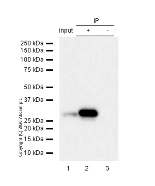 Immunoprecipitation - Anti-GCLM antibody [EPR6667] (AB126704)