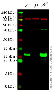 Western blot - Anti-GCLM antibody [EPR6667] (AB126704)