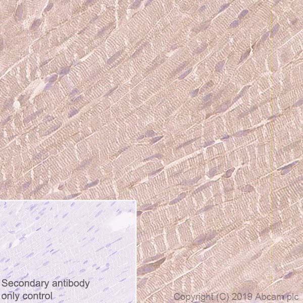 Immunohistochemistry (Formalin/PFA-fixed paraffin-embedded sections) - Anti-GCLM antibody [EPR6667] - BSA and Azide free (AB248137), expandable thumbnail