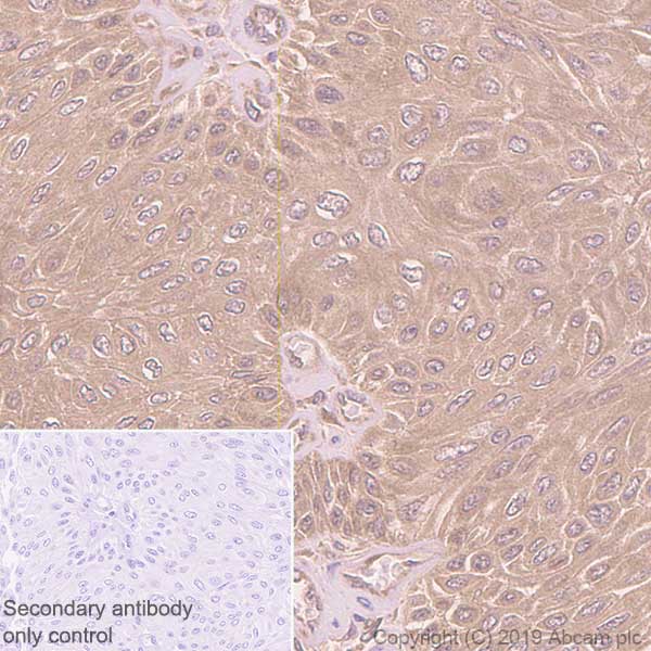Immunohistochemistry (Formalin/PFA-fixed paraffin-embedded sections) - Anti-GCLM antibody [EPR6667] - BSA and Azide free (AB248137), expandable thumbnail