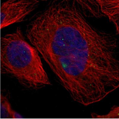 Immunocytochemistry/ Immunofluorescence - Anti-GCM1 antibody - C-terminal (AB187860)