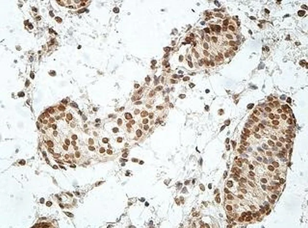 Immunohistochemistry (Formalin/PFA-fixed paraffin-embedded sections) - Anti-GCM2 antibody (AB201170)