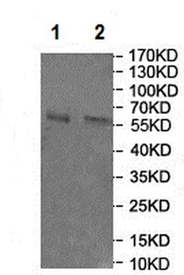 Western blot - Anti-GCM2 antibody (AB201170)