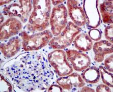 Immunohistochemistry (Formalin/PFA-fixed paraffin-embedded sections) - Anti-GCN2 antibody [EPR5970(2)] (AB134053)