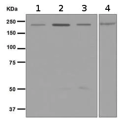 Western blot - Anti-GCN2 antibody [EPR5970(2)] (AB134053)