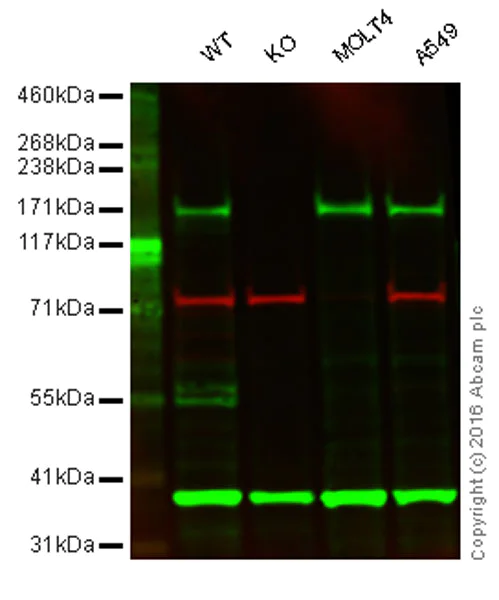 Western blot - Anti-GCN2 antibody [EPR5970(2)] (AB134053)