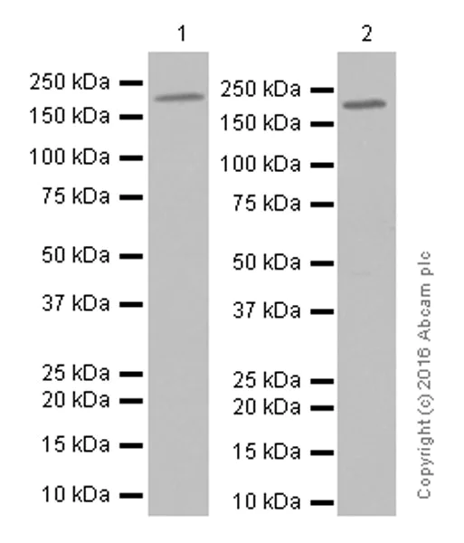 Western blot - Anti-GCN2 antibody [EPR5970(2)] (AB134053)
