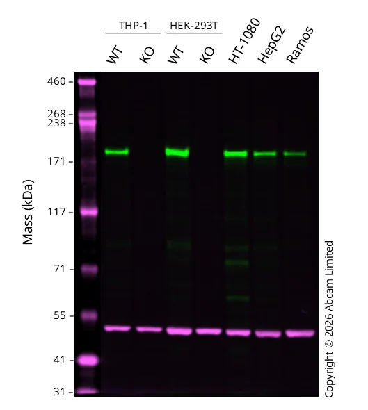 Western blot - Anti-GCN2 antibody [EPR5970(2)] (AB134053)